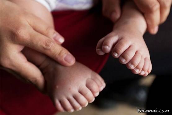 تولد نوزاد 31 انگشتی در چین + تصاویر
