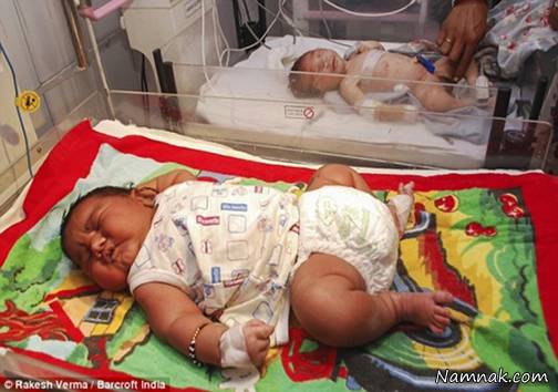 نوزاد پسر 6 کیلویی در هند به دنیا آمد