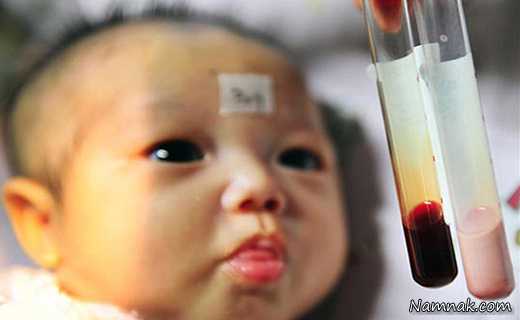 تولد نوزادی عجیب با خون صورتی + عکس
