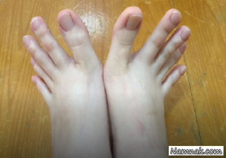 دختر تایوانی با انگشتان عجیب و غریب + تصاویر
