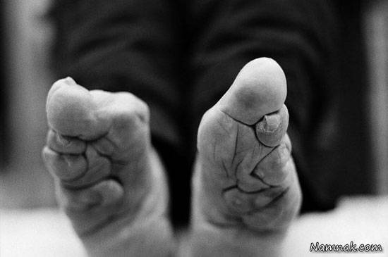 سنت های عجیب از بستن پاها تا دراز کردن جمجمه + تصاویر