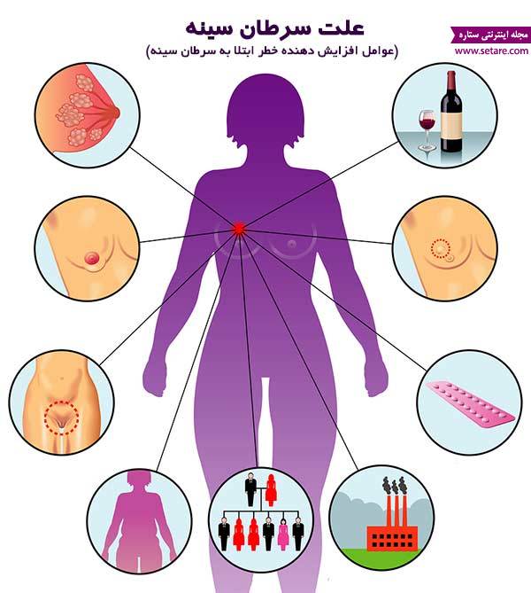 	علت سرطان سینه چیست؟