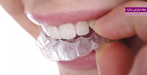 	ارتودنسی چیست؟ + مراحل، بهترین زمان و هزینه ارتودنسی دندان | وب 