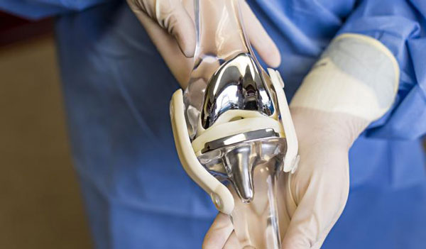 	جراحی تعویض مفصل زانو چیست؟