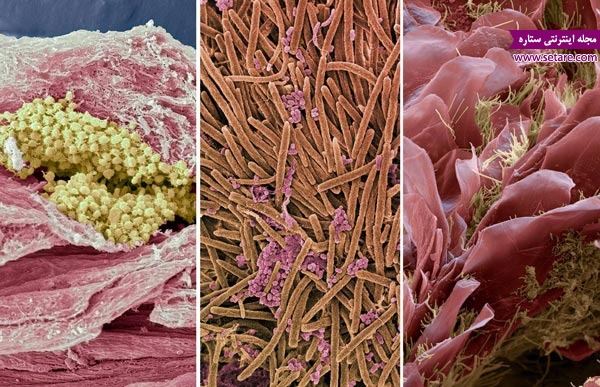 	عکس های میکروسکوپی اعجاب‌انگیز از داخل دهان و دندان‌ها