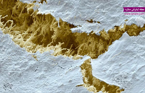 	عکس های میکروسکوپی اعجاب‌انگیز از داخل دهان و دندان‌ها | وب 