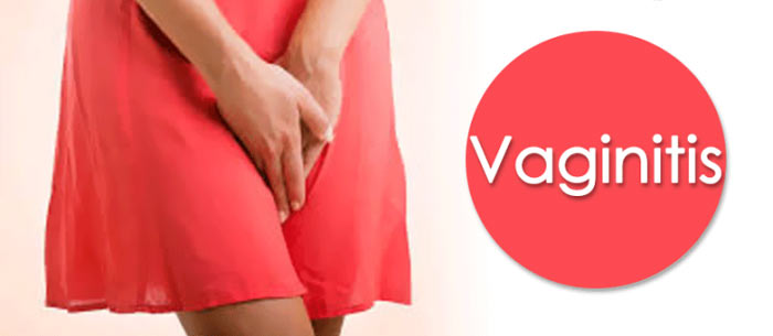 	علت و علائم عفونت واژن چیست و چگونه درمان می شود؟ | وب 