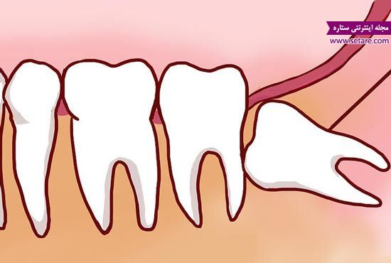 	مشکلات و بیماری های دندان را بیشتر بشناسید | وب 