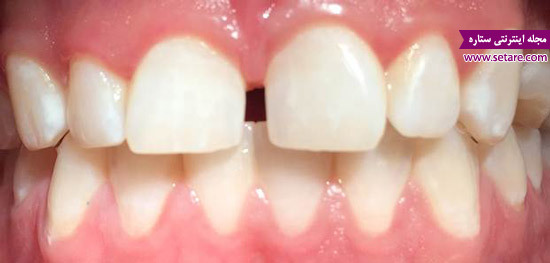 	مشکلات و بیماری های دندان را بیشتر بشناسید | وب 