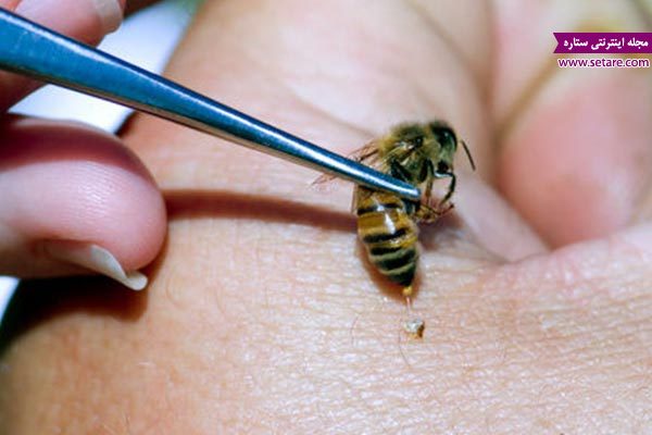 	درمان خانگی نیش زنبور (درمان نیش زنبور با داروهای گیاهی)