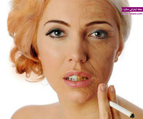 	عوارض و مضرات سیگار کشیدن بر ظاهر (پوست،مو ، چهره و...)
