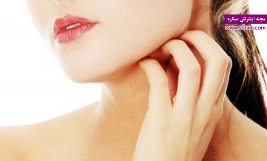 	حساسیت پوستی چیست و چگونه درمان می شود؟ | وب 