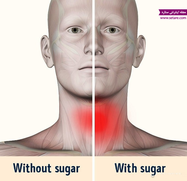 	4 ویژگی خطرناک مصرف شکر که از آن بی خبرید! | وب 