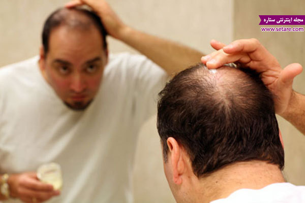 	درمان ریزش مو در طب سنتی برای مردان + راهکارهای رویش مجدد مو