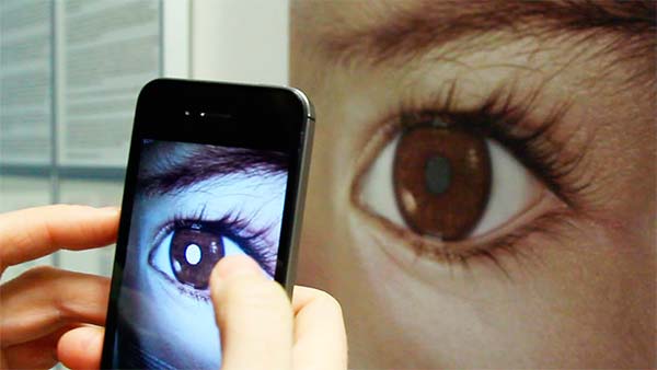 	تشخیص سرطان چشم از طریق عکس با موبایل‌ های هوشمند