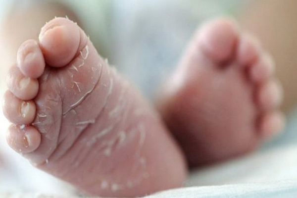 آیا پوست انداختن نوزاد، نگران کننده است؟