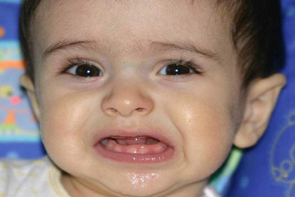 آیا آبریزش بینی نوزاد می تواند از علائم دندان درآوردن باشد؟ | وب 