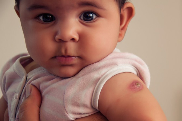 واکسن بدو تولد نوزاد خود را می شناسید؟