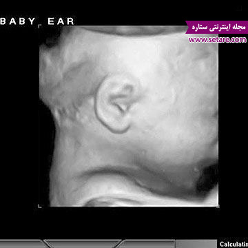 	هفته سی و پنجم بارداری، جنین در دهانه رحم | وب 