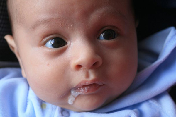 بالا آوردن شیر نوزاد و یا رفلاکس در نوزادان چه علتی دارد؟