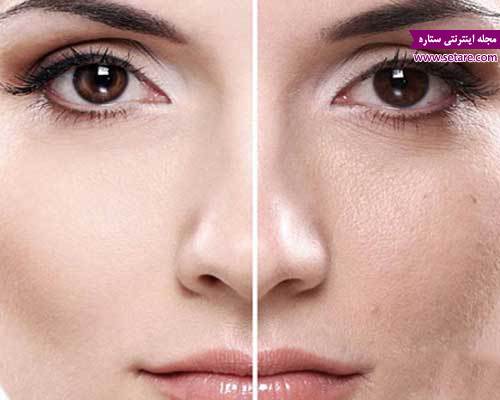 	ماسک آب برنج برای صورت و شفافیت پوست | وب 