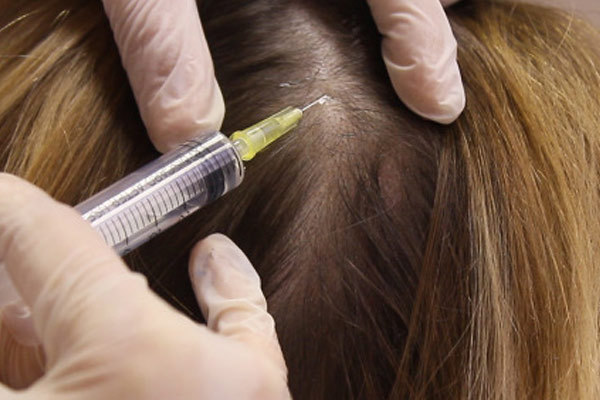 روش های ترمیم مو؛ جدیدترین روش ترمیم مو چیست؟ | وب 