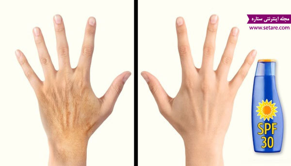 	5 راز طلایی برای جوان کردن پوست دست | وب 
