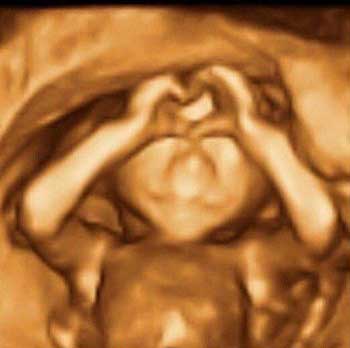 ژست بامزه نوزاد در شکم مادرش در زمان سونوگرافی! عکس